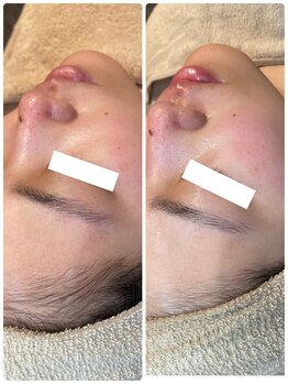 ディオーネ 春日井勝川店(Dione)/マーメイドセルトリートメント