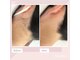 脱毛アンドフェイシャルサロン ルアーナ 心斎橋(LUANA)の写真