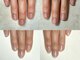 ネイル アンチュ(Nail Anchu)の写真/コンプレックス爪/トラブル爪/深爪/ちび爪など、爪のお悩みを改善◎褒められ美爪が叶うサロン♪