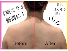 トリニティスペース(TrinitySpace)の雰囲気（国家資格者による肩甲骨はがしが人気！もっこり首にも◎）