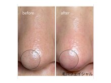 リリアン(lirien)の雰囲気（人気No.1毛穴洗浄☆毛穴のザラつき・黒ずみ解消！！毛穴/駒込）