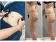 アイ アンド ネイル(Eye＆Nail Day)の写真