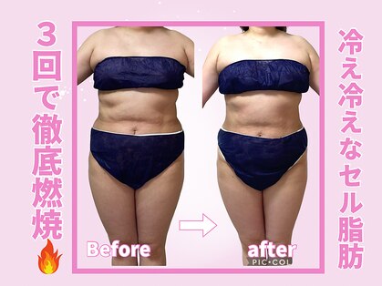 ヨサパーク モイモイ(YOSA PARK moimoi)の写真