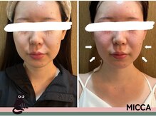 ヨサパーク ミッカ 学芸大学(YOSA PARK MiCCA.)/水素の力！シミシワタルミ