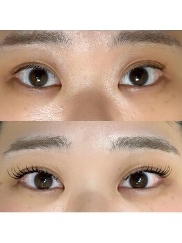 バニーアイズ 天神(Bunny eyes TENJIN)/エクパ140本