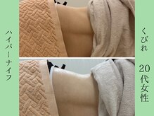 ソルニス(Solnis.)/痩身☆脂肪分解/ハイパーナイフ