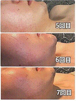 シンバ 南草津店(SIMBA)/☆ ビフォーアフター ☆