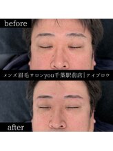 ユー 千葉駅前店(you)/ビフォ－アフター写真