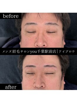 ユー 千葉駅前店(you)/ビフォ－アフター写真