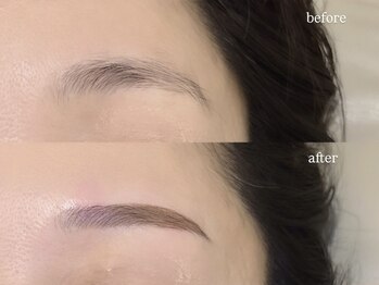 レーヴラグゼ(REVE LUXE)/before/after