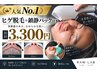 【人気No.1】ヒゲ脱毛＋鎮静パック付き｜45分 | 通常￥4,400→