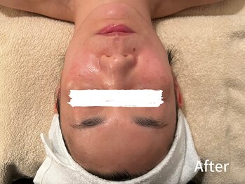 ダイヤモンド リーエンダ(Diamond leende)/クレイハーブピーリング