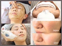 ノア(NoA)の雰囲気（完全プライベートサロンでお肌のお悩みを解決いたします）