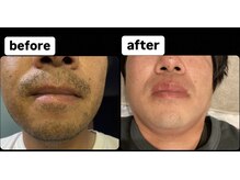 ゴッド(GOD)/ビフォーアフター