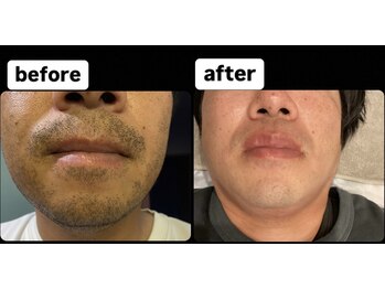 ゴッド(GOD)/ビフォーアフター