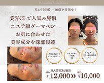 キサラ(Kisara)