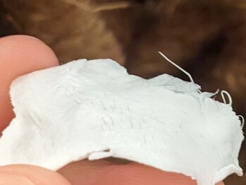 ムーン 横浜(MOON)/【小鼻の角栓ゴッソリ！！】