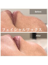 ルナ(LUNA)/フェイシャルワックス