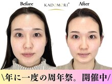 カドモリ 四ツ橋(KADOMORI)