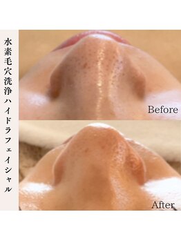 プラウド(Proud)/毛穴洗浄ケア