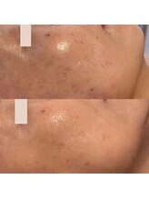 アン(An)/大人の肌悩み