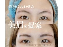 ヴィクトリア アイ(victoriaeye)