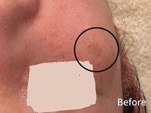 ダイヤモンド リーエンダ(Diamond leende)/クレイハーブピーリング