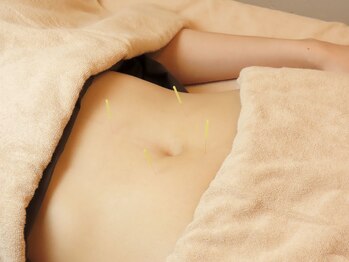 七彩鍼灸院/【鍼灸/美容鍼/恵比寿/代官山】