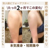 ヴィクトワール シュエット