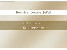 ビューティズムラウンジ 本郷三丁目店(Beautism Lounge)/【ボディ】ビフォーアフター