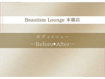 ビューティズムラウンジ 本郷三丁目店(Beautism Lounge)/【ボディ】ビフォーアフター