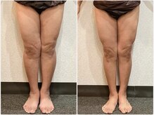 美容整体 ウェリナ 蟹江院/小顔矯正/骨盤矯正/美脚サロン 