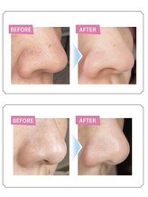 サロンピュア 所沢店/ハイドロスプラッシュ