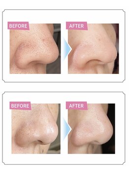 サロンピュア 所沢店/ハイドロスプラッシュ