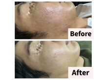 レン(Ren)の雰囲気（多くのメンズのお客様にもご来店頂いてますので初めてでも安心◎）