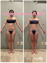 エクセレントビューティーサロン 艶(EN)/サブスクリプション　下半身ケア