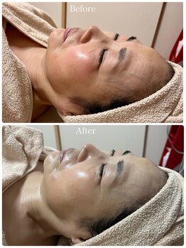 コア(Coeur)/【本格肌管理】オールハンド美肌