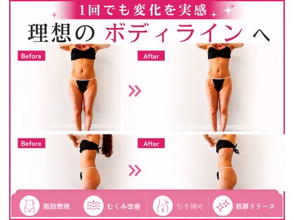 バブルビューティー(Bubble beauty)の写真