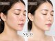 ニコ(NICO)の写真/【夏の紫外線ダメージ、秋のうちにリセットケア☆】韓国肌管理「ララピール」
