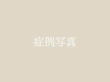 ユウサク(Yusaku)/【小顔矯正/美容鍼/本町/梅田】