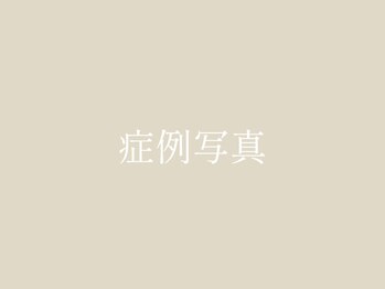 ユウサク(Yusaku)/【小顔矯正/美容鍼/本町/梅田】