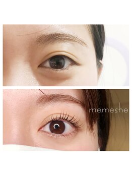 メメシー 相模原(memeshe)/ビフォー/ アフター