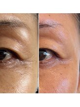 RKボディアンドフェイシャルサロン(RK body&facial salon)/セルラム4回目の方の変化