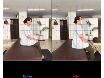 ストレチックス 近江八幡店/before/after