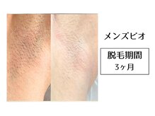 メンズビオ 神戸三宮店/