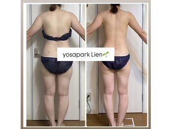 ヨサパーク リアン(YOSA PARK Lien)/モニター様before→after/痩身
