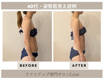 リヨン(Lyon)/（40代）姿勢改善・下腹スッキリ