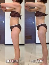 インディバサロン ド メイリィチィフゥア(indibasalon de meiliqihua)/1回の施術でスッキリボディ