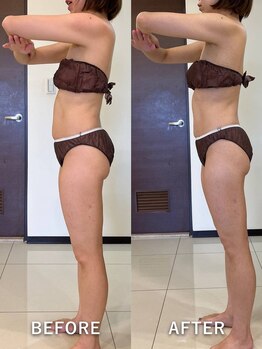 インディバサロン ド メイリィチィフゥア(indibasalon de meiliqihua)/1回の施術でスッキリボディ