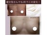 【痩せ型さん専用】ホルモン・栄養をバストへ届ける施術90分¥26,000→¥16,500